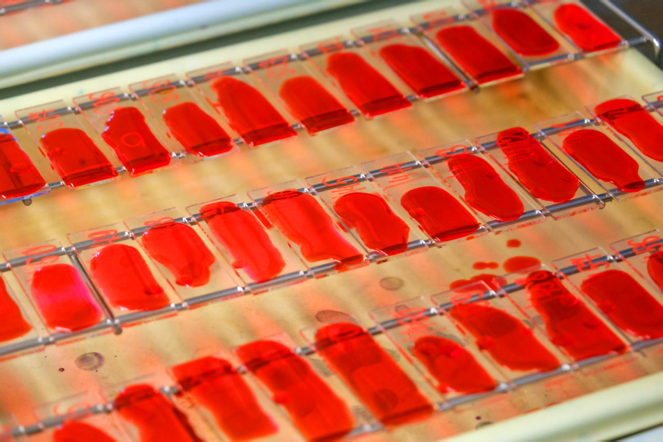 Медисследования