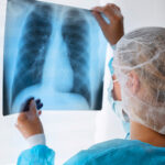 В три раза за два года уменьшилось число впервые заболевших туберкулезом в Новосибирской области